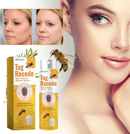 Tag Recede Bee Venom, TagRecede Bee Venom Treatment Spray (1 Piece)